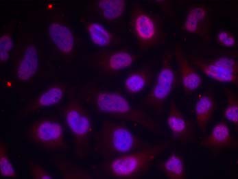 MEF2A (Phospho-Thr312) Antibody