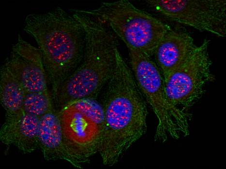 MEF2A (Phospho-Thr319) Antibody