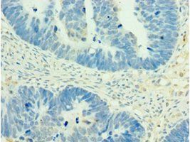 MEF2C Antibody