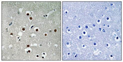 MEF2C (Phospho-Ser396) Antibody
