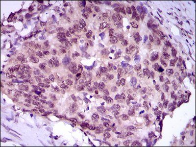 MEF2C Antibody