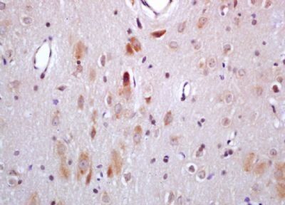 MEF2C Rabbit Polyclonal Antibody