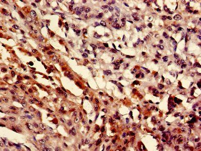 MEF2D Antibody