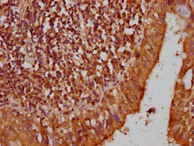 MEFV Antibody