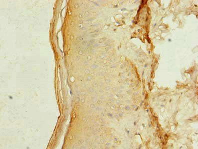 MEI1 Antibody