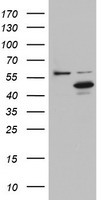 Meis homeobox 3 Antibody