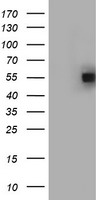 Meis homeobox 3 Antibody