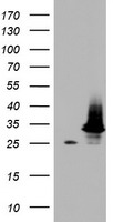 Meis homeobox 3 Antibody
