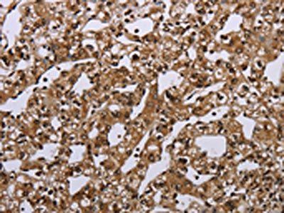 MEIS1 Antibody