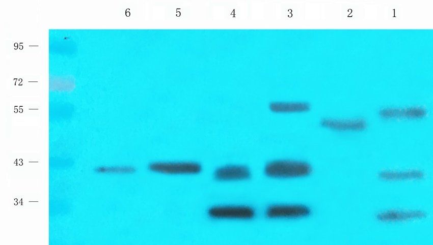 MEIS1 antibody