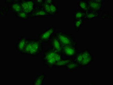 MEIS2 Antibody