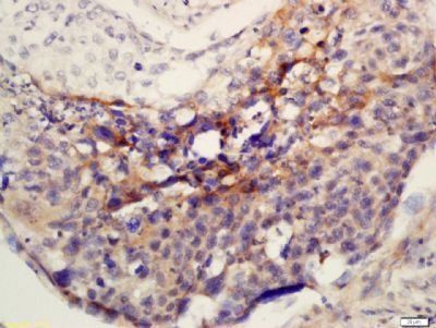Phospho-MEK1/2 (Ser218 + Ser222) Rabbit Polyclonal Antibody