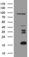 MAP2K1 Antibody