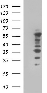 MEK1 Antibody