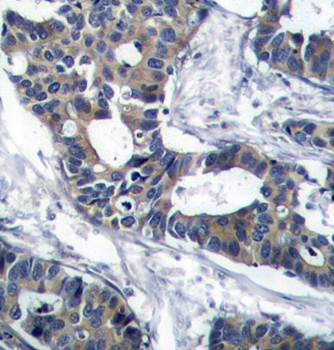 MEK1 (Ab-291) Antibody