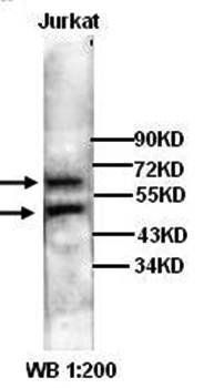 MEK1 Rabbit Polyclonal Antibody