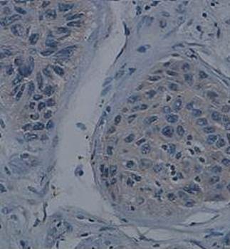 MEK1 Rabbit Polyclonal Antibody