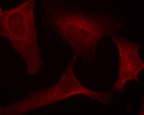 MEK1 (Phospho-Ser221) Antibody