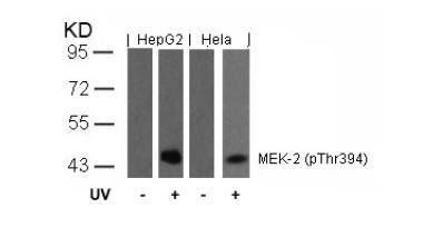 MEK-2 (Phospho-Thr394) Antibody