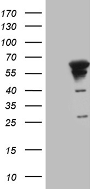 MelanA Antibody