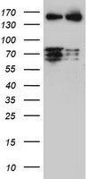 MelanA Antibody