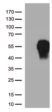MelanA Antibody