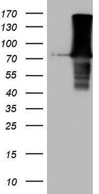 MelanA Antibody