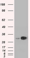 Melanoma gp100 Antibody