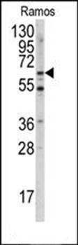 MEN1 antibody