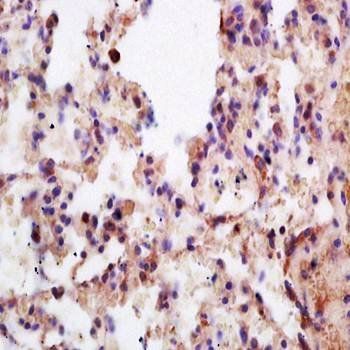 Menin Rabbit Polyclonal Antibody