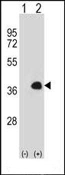 MEOX1 antibody