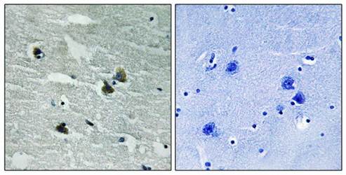 MER/SKY (phospho-Tyr749/681) antibody