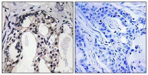 Merlin (Phospho-Ser10) Antibody