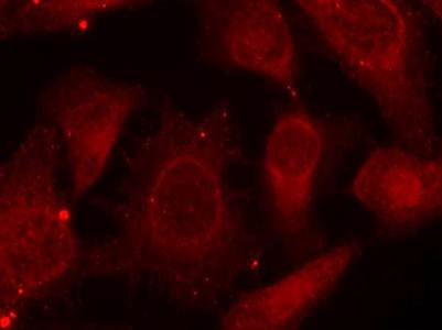 Merlin (Phospho-Ser518) Antibody