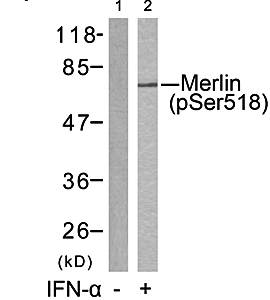 Merlin (Phospho-Ser518) Antibody
