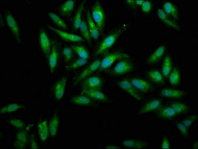 MSLN Antibody