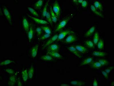 Mesothelin antibody