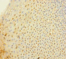 MSLN Antibody