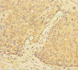 MSLN Antibody