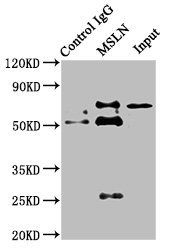 Mesothelin antibody