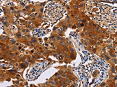 MSLN Antibody