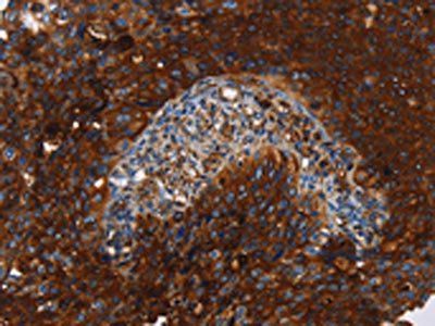 MSLN Antibody