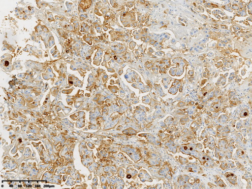 Mesothelin Antibody