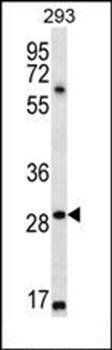 MESP1 antibody