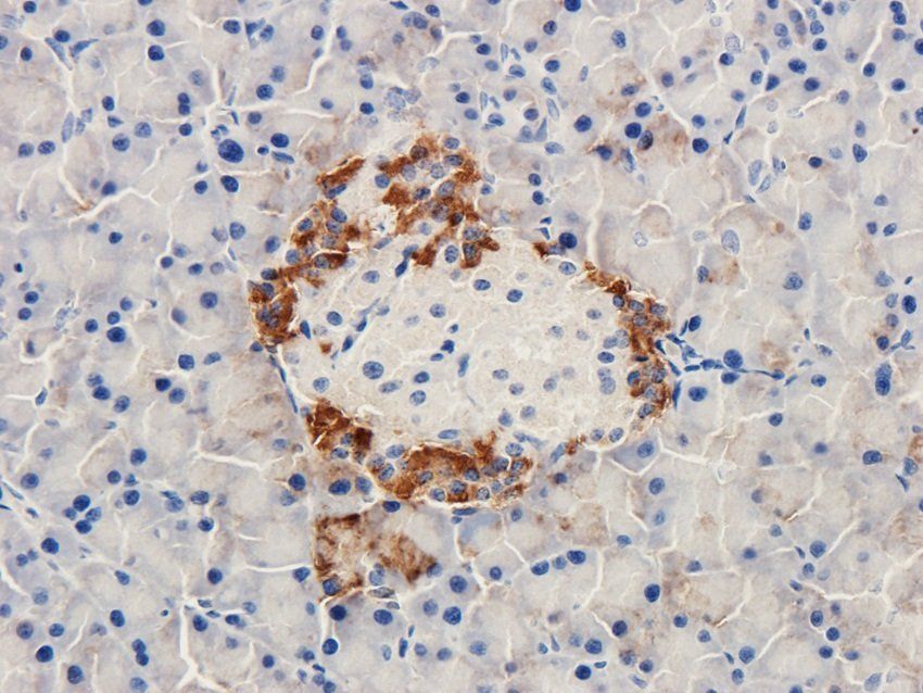 MESP1 antibody