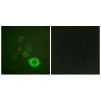 MET Antibody