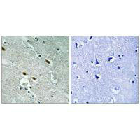MET Antibody