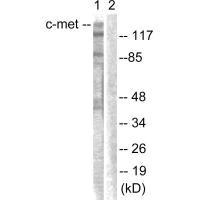 MET Antibody