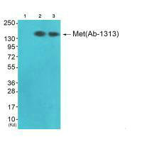 MET Antibody