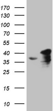 MET Antibody